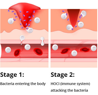 hocl-process